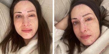 Alldaynews.gr Ιωάννα Παλιοσπύρου: «Ακόμα παλεύω να αποδεχτώ τον νέο μου εαυτό»-Φωτογραφίες χωρίς ίχνος make up