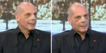 Alldaynews.gr Η πρώτη εμφάνιση του Βαρουφάκη με σπασμένη μύτη μετά την επίθεση στα Εξάρχεια και η απαίτηση της συζύγου του (video)