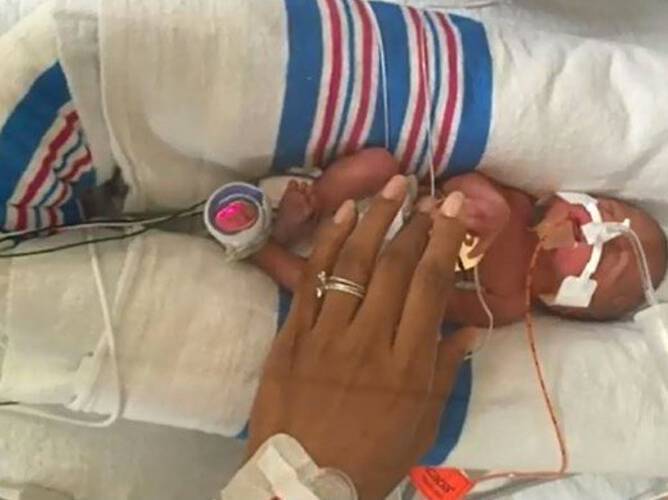 Άφησε ένα χειρουργικό γάντι στην θερμοκοιτίδα του εφταμηνίτικου μωρού της. Όταν οι Νοσοκόμες έμαθαν τον λόγο, τα έχασαν