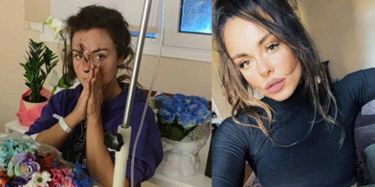 Ευδοκία Τσαγκλή: Η πρώην παίκτρια του Big Brother ήταν στο βαγόνι 3 – «Έπρεπε να αποφασίσω αν θα καώ ή θα σπάσω τα κόκαλά μου»