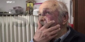 Άγριο ξύλο σε ηλικιωμένο: Του έσπασαν και δόντια για 80 ευρώ – Οι εφιαλτικές στιγμές που έζησε