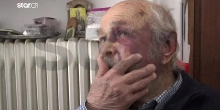 Άγριο ξύλο σε ηλικιωμένο: Του έσπασαν και δόντια για 80 ευρώ – Οι εφιαλτικές στιγμές που έζησε