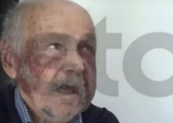 Alldaynews.gr Φρίκη με ληστεία στην Χαλκίδα: Σακάτεψαν 90χρονο παππού, του έβγαλαν μέχρι και τα δόντια