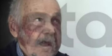 Alldaynews.gr Φρίκη με ληστεία στην Χαλκίδα: Σακάτεψαν 90χρονο παππού, του έβγαλαν μέχρι και τα δόντια