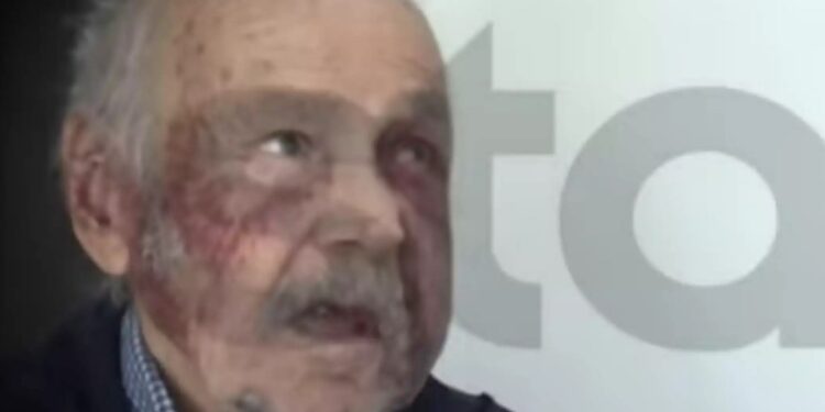 Alldaynews.gr Φρίκη με ληστεία στην Χαλκίδα: Σακάτεψαν 90χρονο παππού, του έβγαλαν μέχρι και τα δόντια