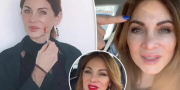 Alldaynews.gr Έκανε μπότοξ στο πρόσωπο για 20 χρόνια και δείχνει πώς είναι τώρα που σταμάτησε