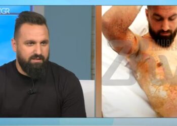 Συγκλονιστικό: Ο Άρης Θωμάς χτυπήθηκε από 20.000 volt και περιγράφει τη μεταθανάτια εμπειρία του (video)