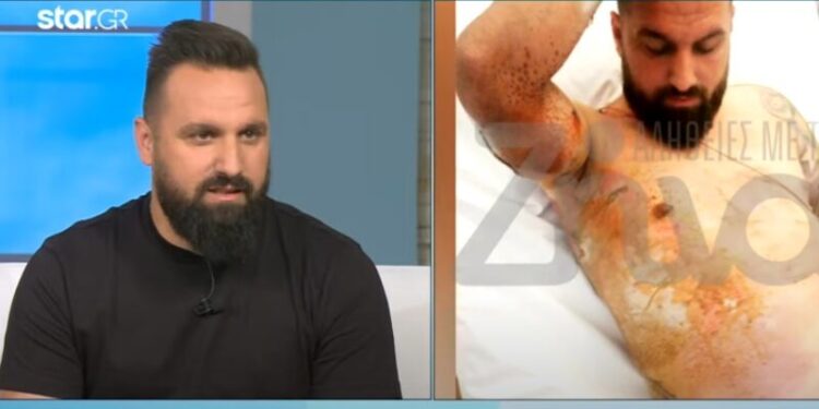 Συγκλονιστικό: Ο Άρης Θωμάς χτυπήθηκε από 20.000 volt και περιγράφει τη μεταθανάτια εμπειρία του (video)