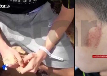 Alldaynews.gr Θύμα bullying και άγριου ξύλου έπεσε 14χρονος από συνομήλικούς του έξω από σχολείο – Τα άκουγε όλα η μητέρα του στο τηλέφωνο