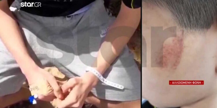 Alldaynews.gr Θύμα bullying και άγριου ξύλου έπεσε 14χρονος από συνομήλικούς του έξω από σχολείο – Τα άκουγε όλα η μητέρα του στο τηλέφωνο