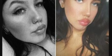 σκουπίδια μωρό