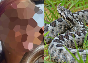 Τσίμπημα Οχιάς στη Θεσσαλονίκη: Σοβαρή η κατάσταση της 39χρονης μητέρας ενός παιδιού