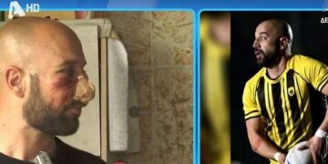Alldaynews.gr Ξυλοκοπήθηκε άγρια αθλητής της ΑΕΚ – Μάρτυρας η μητέρα του που ούρλιαζε (video)