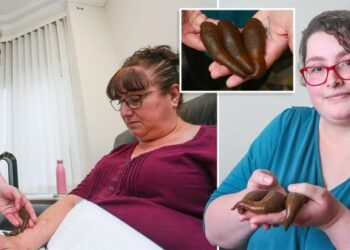 Πήρε για κατοικίδια 35 βδέλλες και τις χρησιμοποιεί για τη θεραπεία της αρθρίτιδας της μαμάς της (φωτο, video)