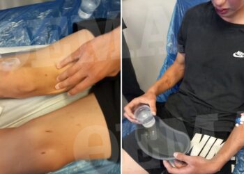 Alldaynews.gr «Τον κάνανε τσουβάλι στις κλωτσιές» λένε οι γονείς του 16χρονου που ξυλοκοπήθηκε από συμμορία ανηλίκων (φωτο, video)