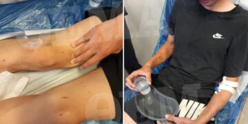 Alldaynews.gr «Τον κάνανε τσουβάλι στις κλωτσιές» λένε οι γονείς του 16χρονου που ξυλοκοπήθηκε από συμμορία ανηλίκων (φωτο, video)