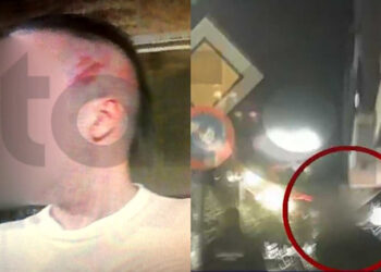 Alldaynews.gr Ντελιβεράς πλάκωσε στο ξύλο μητέρα και γιο γιατί του έγινε παρατήρηση – Της ξερίζωσε τούφα από τα μαλλιά (φωτο, video)