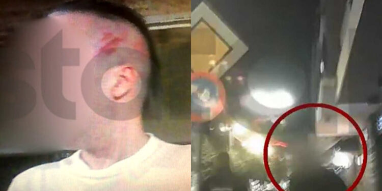 Alldaynews.gr Ντελιβεράς πλάκωσε στο ξύλο μητέρα και γιο γιατί του έγινε παρατήρηση – Της ξερίζωσε τούφα από τα μαλλιά (φωτο, video)