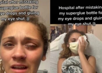 Γυναίκα κατέληξε στο νοσοκομείο καθώς μπέρδεψε το κολλύριο με κόλλα (video)