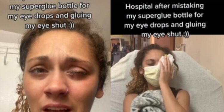 Alldaynews.gr Γυναίκα κατέληξε στο νοσοκομείο καθώς μπέρδεψε το κολλύριο με κόλλα (video)