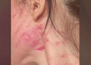 Alldaynews.gr Του ζήτησε να χωρίσουν και την έσπασε στο ξύλο: «Όπου την βρει, στο δρόμο, στην δουλειά της πηγαίνει, την ξυλοκοπεί…