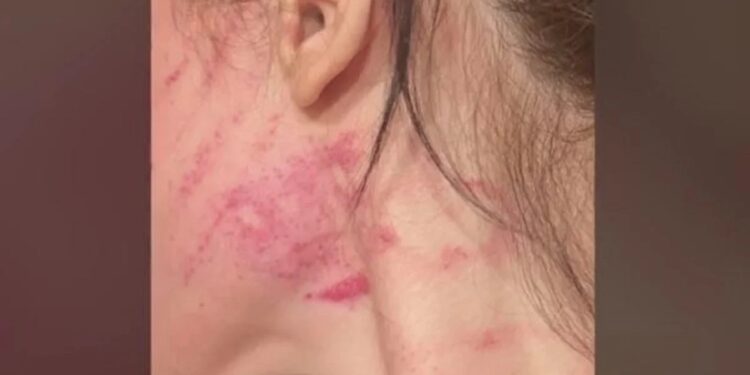 Του ζήτησε να χωρίσουν και την έσπασε στο ξύλο: «Όπου την βρει, στο δρόμο, στην δουλειά της πηγαίνει, την ξυλοκοπεί…