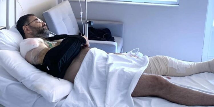 Alldaynews.gr Σταύρος Μπαλάσκας: «Έπαψα να έχω δεξί χέρι, ήταν ένα κρeμασμένο κομμάτι κρέας πάνω μου»-Η Τραγική Σύμπτωση