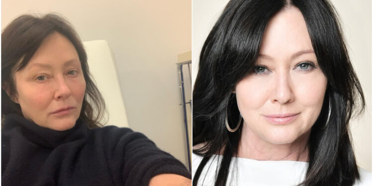 Alldaynews.gr Ο καρκίνος της Σάνεν Ντόχερτι έκανε μετάσταση στον εγκέφαλο και ανέβασε βίντεο από την ακτινοθεραπεία