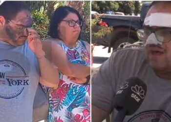 «Οι υπεύθυνοι με έβαλαν σε ψυγείο με κρέατα»! Συγκλονίζει ο μάγειρας που κάηκε με λάδι-Τον είχαν και Ανασφάλιστο[video]