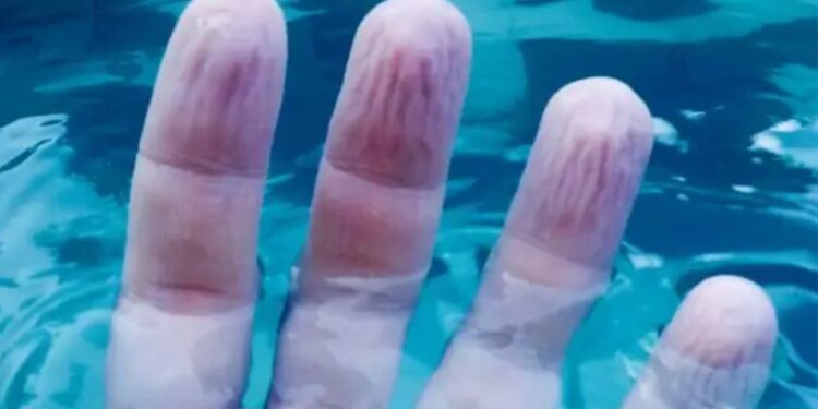 Alldaynews.gr Γιατί μουλιάζουν τα χέρια όταν μένουμε πολλή ώρα στο νερό – Πότε να ανησυχήσετε