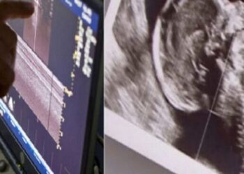 Ζευγάρι με δίδυμα περιμένει και πάλι παιδί, αλλά ο γιατρός δείχνει το υπερηχογράφημα και ο σύζυγος αμέσως λιποθυμά