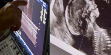 Ζευγάρι με δίδυμα περιμένει και πάλι παιδί, αλλά ο γιατρός δείχνει το υπερηχογράφημα και ο σύζυγος αμέσως λιποθυμά