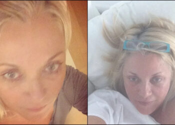 Σοκάρει η Ρούλα Κορομηλά: «Δίνω μάχη με ένα θηρίο που ζει μέσα στο σώμα μου. Ξεκίνησε άγριο και επιθετικό»