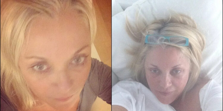 Σοκάρει η Ρούλα Κορομηλά: «Δίνω μάχη με ένα θηρίο που ζει μέσα στο σώμα μου. Ξεκίνησε άγριο και επιθετικό»