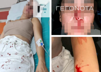 Alldaynews.gr «Έπεσε, τι δεν καταλαβαίνετε»: Σοκάρουν τα τραύματα της 30χρονης – Δεν εμφανίστηκε ο διεθνής αθλητής (φωτο)