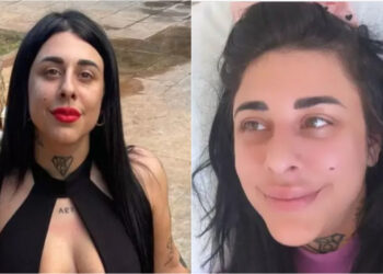 Στο νοσοκομείο η Super Κική – Έκανε εγχείρηση για να αφαιρέσει το λίπος στα μπούτια της