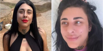 Alldaynews.gr Στο νοσοκομείο η Super Κική – Έκανε εγχείρηση για να αφαιρέσει το λίπος στα μπούτια της