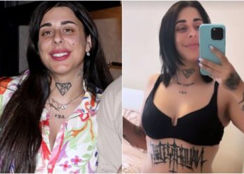 Χωρίς ρούχα η Super Κική: Δείχνει το σώμα της μετά τη λιποαναρρόφηση – Δείτε φωτογραφίες