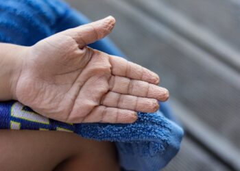 Όταν κάνεις μπάνιο: Τι δείχνει για την υγεία σου αν τα δάχτυλά σου μουλιάζουν γρήγορα στο νερό