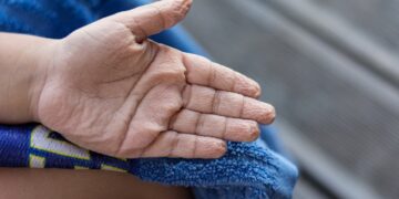 Alldaynews.gr Όταν κάνεις μπάνιο: Τι δείχνει για την υγεία σου αν τα δάχτυλά σου μουλιάζουν γρήγορα στο νερό
