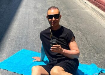 Βασίλειος Κωστέτσος: Έκανε εμφύτευση μαλλιών και μας δείχνει την αλλαγή στην εμφάνισή του