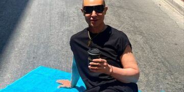 Alldaynews.gr Βασίλειος Κωστέτσος: Έκανε εμφύτευση μαλλιών και μας δείχνει την αλλαγή στην εμφάνισή του