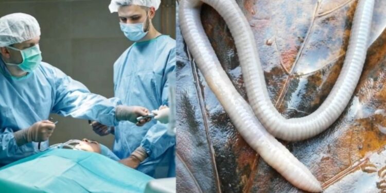 Άφωνοι οι Γιατροί! Βρήκαν ζωντανό σκοuλήκι στον εγκέφαλο γυναίκας, για πρώτη φορά παγκοσμίως[Φωτογραφίες]