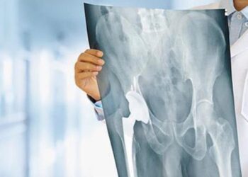 Άφωνοι οι Γιατροί στο νοσοκομείο Μυτιλήνης με 99χρονη μετά από εγχείρηση για κάταγμα ισχύου – Δείτε τι συνέβη