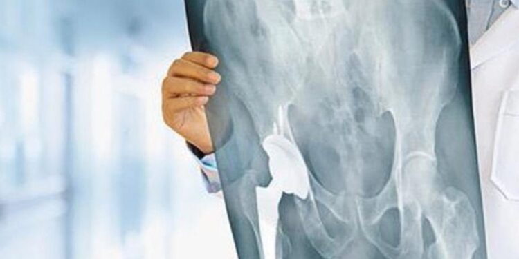 Άφωνοι οι Γιατροί στο νοσοκομείο Μυτιλήνης με 99χρονη μετά από εγχείρηση για κάταγμα ισχύου – Δείτε τι συνέβη