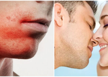 Φiλησα ένα κορίτσι στο πρώτο μας ραντεβού και τα χείλη μου άρχισαν να καίγονται – Σοκαρίστηκα όταν έμαθα γιατί πονούσα