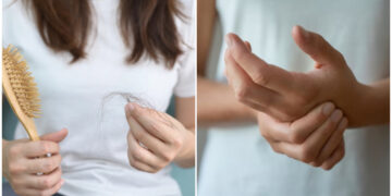 Alldaynews.gr Τα ύπουλα συμπτώματα του λύκου: Τα σημάδια που ΔΕΝ πρέπει ποτέ να αγνοούν οι γυναίκες