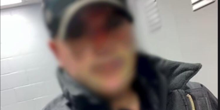 Παντρεμένος Αστυνομικός συνέλαβε την ερωμένη του και την απείλησε ότι «θα τη βγάλει τρελή» επειδή τον χώρισε[Φωτογραφίες]