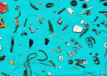 ”Πάγωσαν” οι Γιατροί! Πήγε με στομαχόπονο στο νοσοκομείο και έβγαλαν από το έντερό του 60 αντικείμενα