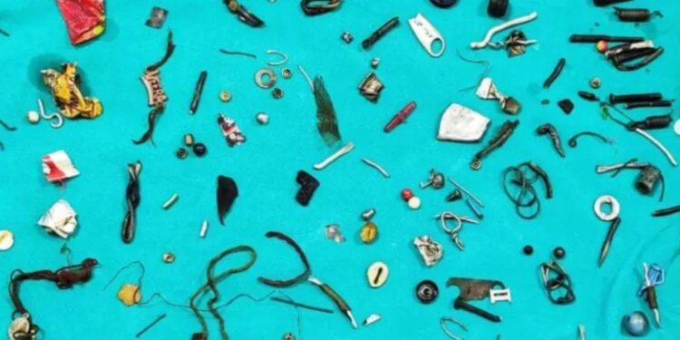 Alldaynews.gr ”Πάγωσαν” οι Γιατροί! Πήγε με στομαχόπονο στο νοσοκομείο και έβγαλαν από το έντερό του 60 αντικείμενα